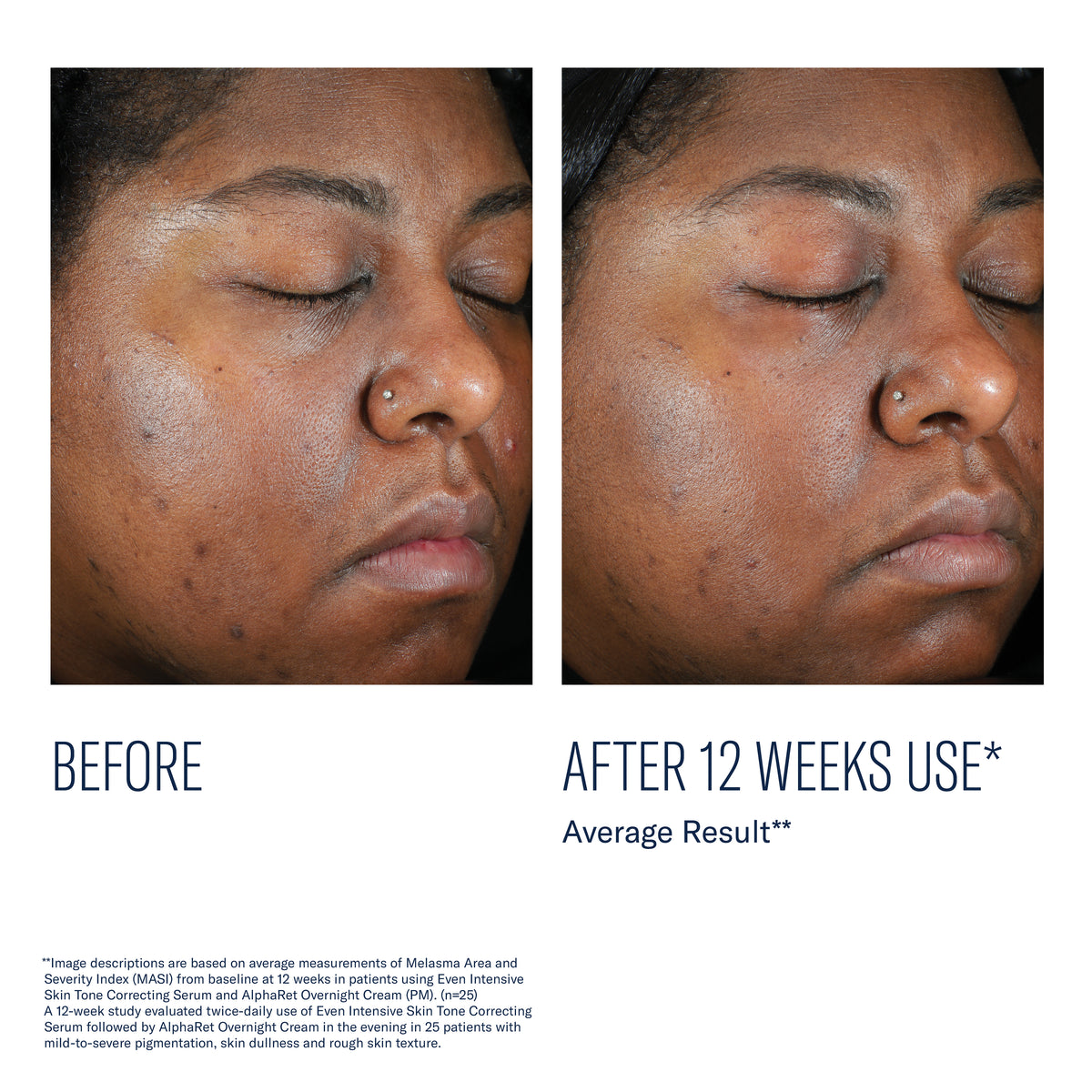 Even Intensive Skin Tone Correcting Serum