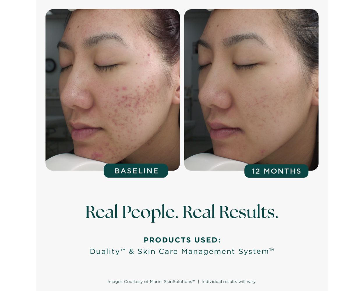 Age Intervention Duality™ MD