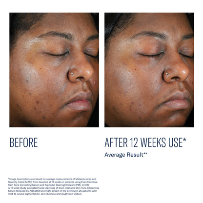 Even Intensive Skin Tone Correcting Serum