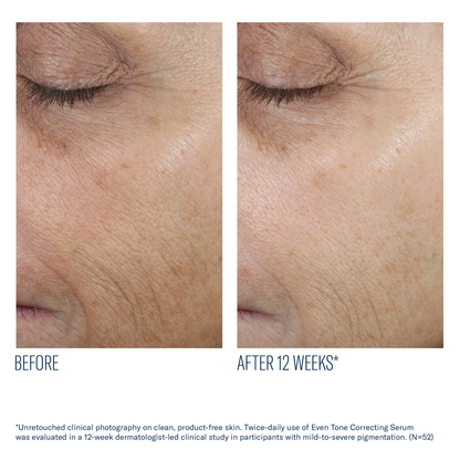 Even Intensive Skin Tone Correcting Serum