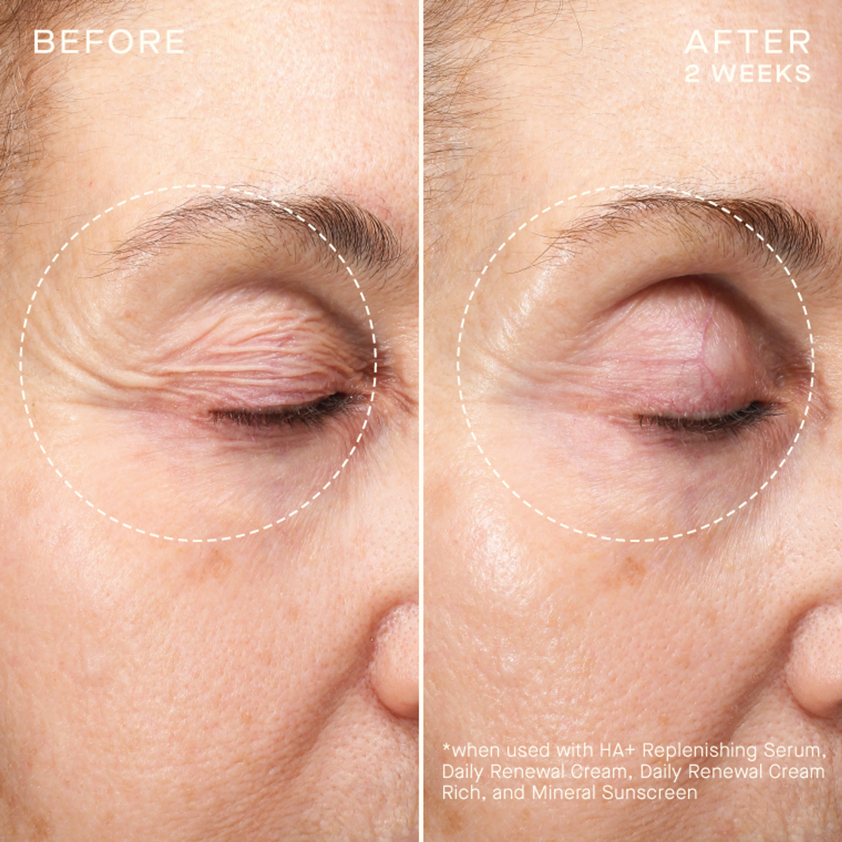 ADVANCED REGENERATIVE SERUM 30ML