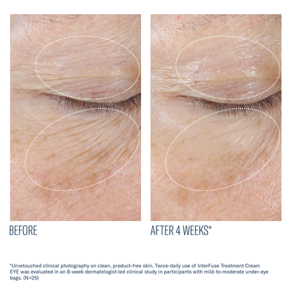 Interfuse Treatment Eye Cream